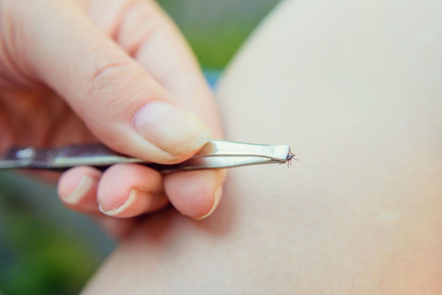 Close-up of a hand holding a tick in tweezers, how to avoid ticks concept.