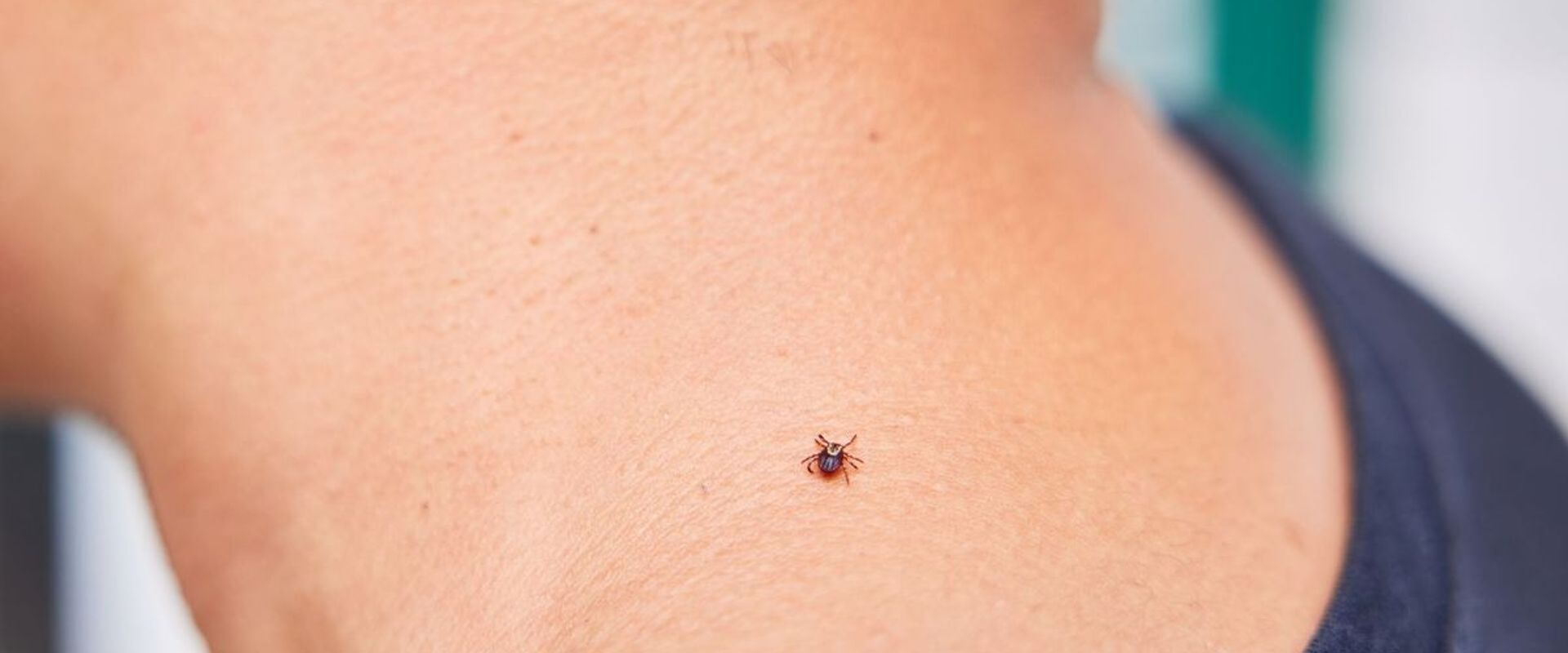 A tick on a person's neck, using permethrin to avoid tick bites concept.